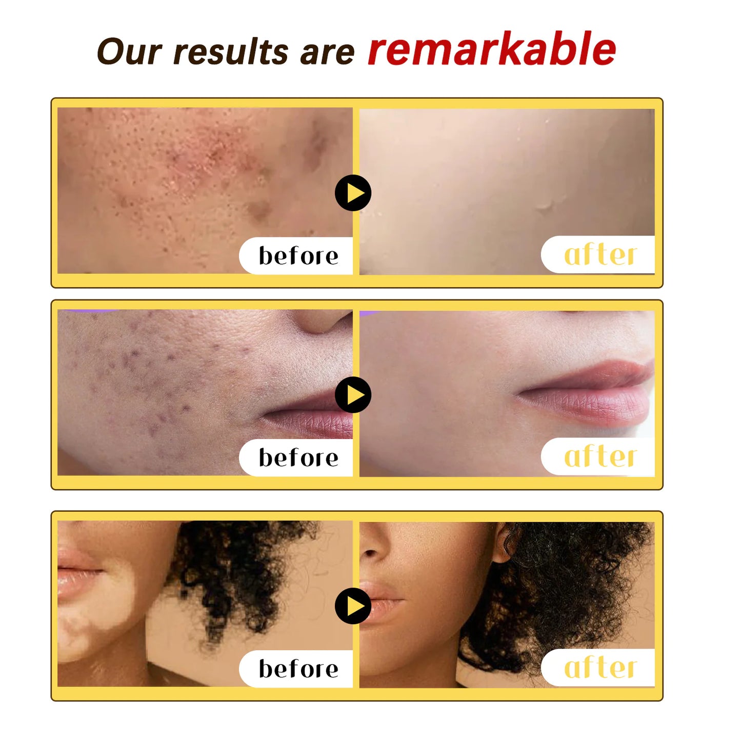Bee Venom Skin Repair Cream