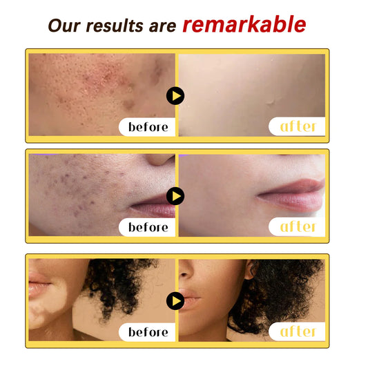 Bee Venom Skin Repair Cream